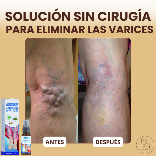 1+1 GRATIS | DERMAVEIN™ -Spray Reparador De Varices