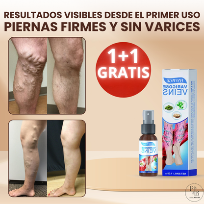 1+1 GRATIS | DERMAVEIN™ -Spray Reparador De Varices